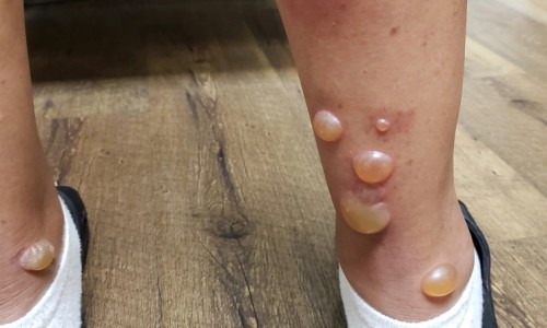 着床期间能不能吃点冰的东西-受精卵着床可以喝冰的吗、着床期间可以喝凉的吗 -着床期间能不能吃点冰的网